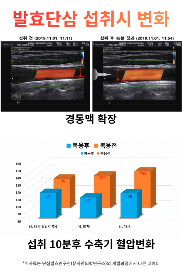 천혈단 섭취 전후 경동맥 초음파 비교